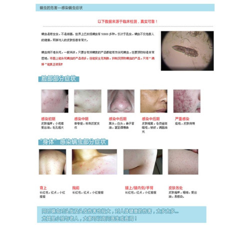 Зволожувальний крем для проблемної шкіри Manting (Мантинг)