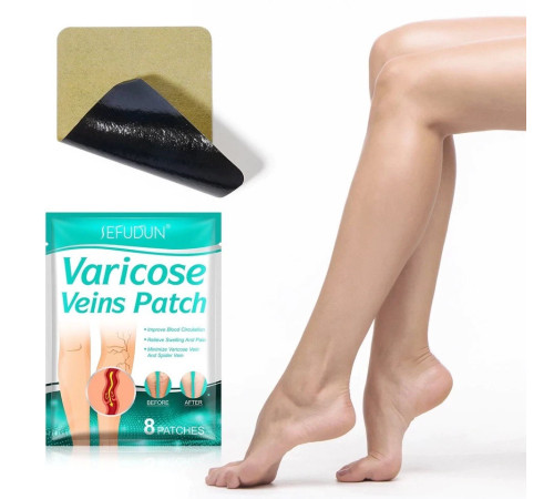 Пластир проти варикозного розширення вен і судинних зірочок на ногах 8 шт.