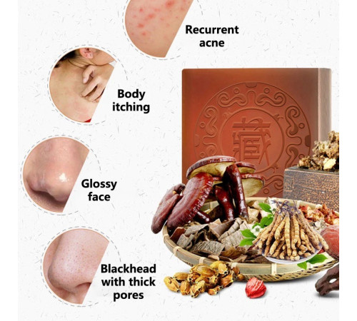 Тибетське мило проти кліща демодекозу, від прищів і висипки на обличчі з кордицепсом і Ганодерма Lucidum Рейші