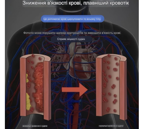 Лазерний терапевтичний кулон-браслет підтримка судин, серця, крові та внутрішньої енергії радості