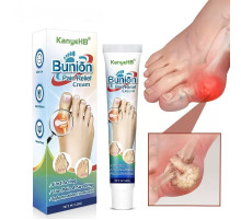 КРЕМ ВІД ШКІРКИ НА НІГЕ (HALLUX VALGUS) Bunion Pain Relief Cream — комфорт, легкість і турбота про ваші ноги щодня