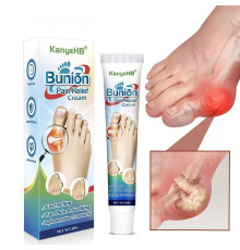 КРЕМ ВІД ШКІРКИ НА НІГЕ (HALLUX VALGUS) Bunion Pain Relief Cream — комфорт, легкість і турбота про ваші ноги щодня