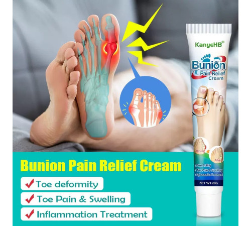 КРЕМ ВІД ШКІРКИ НА НІГЕ (HALLUX VALGUS) Bunion Pain Relief Cream — комфорт, легкість і турбота про ваші ноги щодня