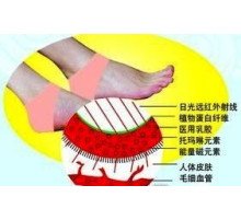 Турмалінові нап'яточники — під час терапії п'ят Вековий Схід